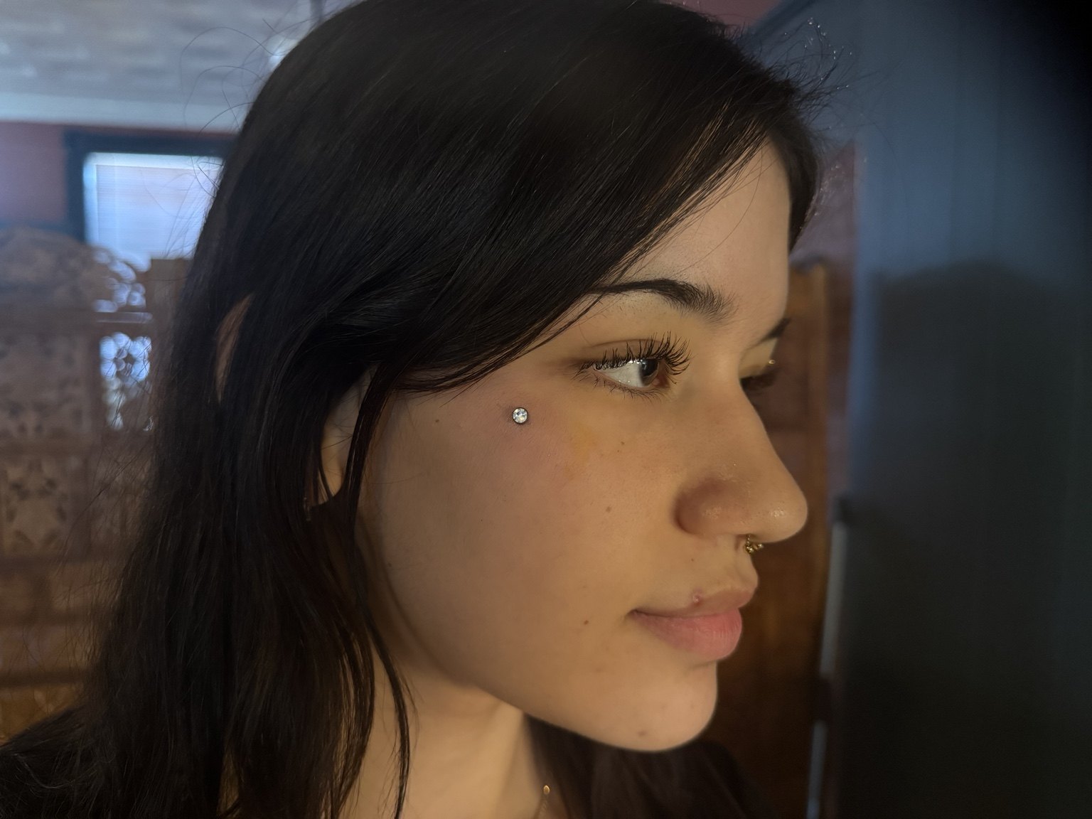 Dermal teardrop piercing